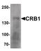 Crumbs Cell Polarity Complex Component 1 antibody, PA5-34491, Invitrogen Antibodies, Western Blot image 