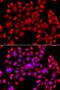 Phosphatidylinositol-5-phosphate 4-kinase type-2 beta antibody, 14-489, ProSci, Immunofluorescence image 