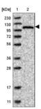 Calcium/Calmodulin Dependent Serine Protein Kinase antibody, NBP1-86673, Novus Biologicals, Western Blot image 