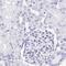Lin-28 Homolog B antibody, PA5-63983, Invitrogen Antibodies, Immunohistochemistry frozen image 