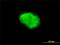 Dephospho-CoA Kinase Domain Containing antibody, H00079877-M02, Novus Biologicals, Immunocytochemistry image 