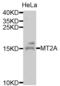 Metallothionein 2A antibody, PA5-76652, Invitrogen Antibodies, Western Blot image 