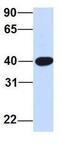 Syntrophin Beta 1 antibody, GTX46866, GeneTex, Western Blot image 