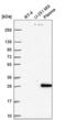 Homeobox D1 antibody, NBP2-58710, Novus Biologicals, Western Blot image 
