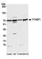 YTH N6-Methyladenosine RNA Binding Protein 1 antibody, NBP2-76361, Novus Biologicals, Western Blot image 