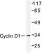 Cyclin D1 antibody, LS-C176594, Lifespan Biosciences, Western Blot image 