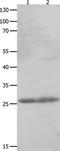 C-Type Lectin Domain Family 4 Member D antibody, TA322106, Origene, Western Blot image 