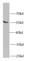 Sarcoglycan Epsilon antibody, FNab07802, FineTest, Western Blot image 