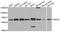 Jumonji Domain Containing 4 antibody, A7992, ABclonal Technology, Western Blot image 
