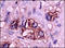Selectin E antibody, 251635, Abbiotec, Immunohistochemistry paraffin image 