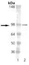 Estrogen Receptor 1 antibody, GTX13538, GeneTex, Western Blot image 