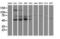 Protein Phosphatase, Mg2+/Mn2+ Dependent 1G antibody, LS-C172541, Lifespan Biosciences, Western Blot image 