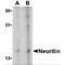 Neuritin 1 antibody, TA306415, Origene, Western Blot image 
