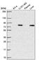 Glycerol-3-Phosphate Acyltransferase, Mitochondrial antibody, NBP2-57241, Novus Biologicals, Western Blot image 