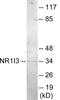 Nuclear Receptor Subfamily 1 Group I Member 3 antibody, EKC1813, Boster Biological Technology, Western Blot image 