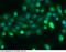 SPARC Like 1 antibody, 10046-MM06, Sino Biological, Immunohistochemistry paraffin image 