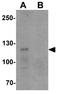 T Cell Immune Regulator 1, ATPase H+ Transporting V0 Subunit A3 antibody, GTX32087, GeneTex, Western Blot image 