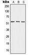 Angiopoietin-4 antibody, LS-C353439, Lifespan Biosciences, Western Blot image 