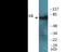 LIM Domain Kinase 1 antibody, EKC2451, Boster Biological Technology, Western Blot image 