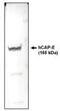 Structural maintenance of chromosomes protein 2 antibody, NBP2-66582, Novus Biologicals, Western Blot image 