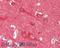 Neuronal Calcium Sensor 1 antibody, A05330-1, Boster Biological Technology, Immunohistochemistry paraffin image 