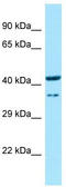 Homeobox D9 antibody, TA343721, Origene, Western Blot image 