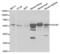 Galactosamine (N-Acetyl)-6-Sulfatase antibody, LS-C334072, Lifespan Biosciences, Western Blot image 