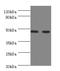 Neuraminidase 3 antibody, A57815-100, Epigentek, Western Blot image 