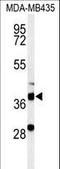 NET50 antibody, LS-C167401, Lifespan Biosciences, Western Blot image 