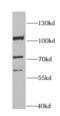 Minichromosome Maintenance Complex Component 4 antibody, FNab05059, FineTest, Western Blot image 