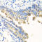 Nyctalopin antibody, 23-212, ProSci, Immunohistochemistry frozen image 