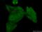 Regulatory Factor X Associated Protein antibody, 20188-1-AP, Proteintech Group, Immunofluorescence image 