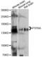 Protein Tyrosine Phosphatase Receptor Type A antibody, A12318, ABclonal Technology, Western Blot image 