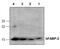 Fatty Acid Binding Protein 3 antibody, GTX59869, GeneTex, Western Blot image 