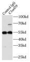 Uncharacterized glycosyltransferase AGO61 antibody, FNab01109, FineTest, Immunoprecipitation image 