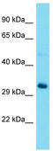 Ribosomal RNA Processing 15 Homolog antibody, TA331717, Origene, Western Blot image 