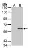 Folylpolyglutamate Synthase antibody, GTX103516, GeneTex, Western Blot image 