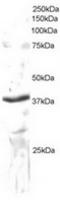 Protein transport protein Sec61 subunit alpha isoform 1 antibody, TA302702, Origene, Western Blot image 
