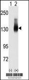 Jagged Canonical Notch Ligand 2 antibody, 62-140, ProSci, Western Blot image 