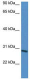 BARX Homeobox 2 antibody, TA333989, Origene, Western Blot image 