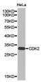 Cyclin Dependent Kinase 2 antibody, TA327365, Origene, Western Blot image 