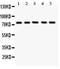 Arachidonate 12-lipoxygenase, 12S-type antibody, PA1485-1, Boster Biological Technology, Western Blot image 