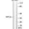 RNA Polymerase III Subunit D antibody, A11611, Boster Biological Technology, Western Blot image 
