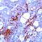 Mucin 1, Cell Surface Associated antibody, GTX15482, GeneTex, Immunohistochemistry paraffin image 