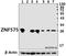 Zinc Finger Protein 575 antibody, GTX66823, GeneTex, Western Blot image 