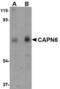 Calpain 6 antibody, TA306628, Origene, Western Blot image 