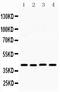MHC Class I Polypeptide-Related Sequence B antibody, PB9613, Boster Biological Technology, Western Blot image 