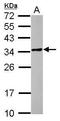 POM121 And ZP3 Fusion antibody, GTX122308, GeneTex, Western Blot image 