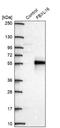 F-Box And Leucine Rich Repeat Protein 16 antibody, NBP2-38789, Novus Biologicals, Western Blot image 