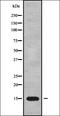 DNA-directed RNA polymerases I and III subunit RPAC2 antibody, orb338260, Biorbyt, Western Blot image 
